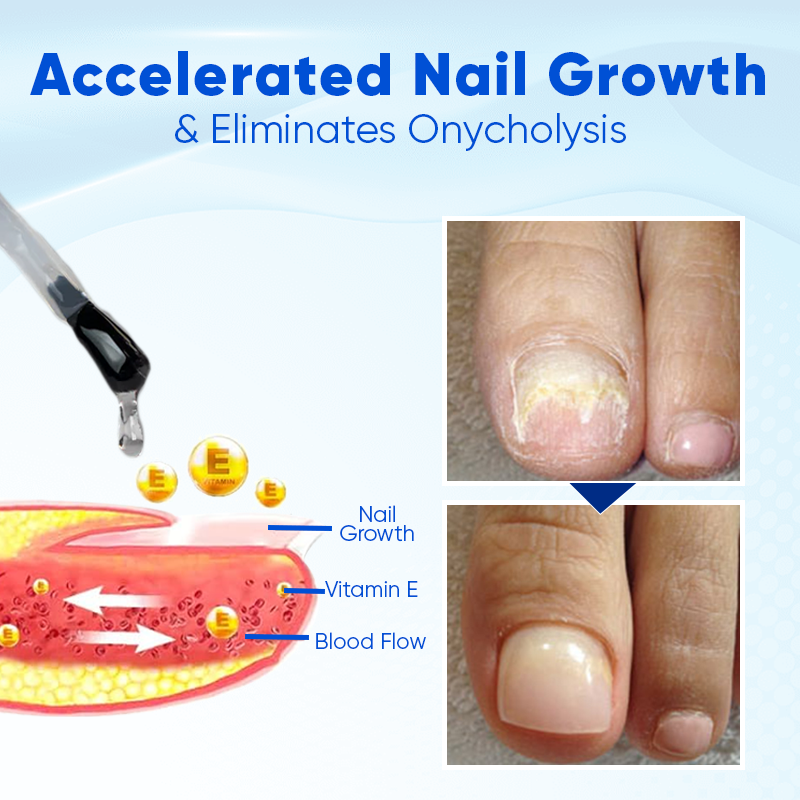 ⚡40% off for a limited time💅Nail Growth and Repair Serum 🩵