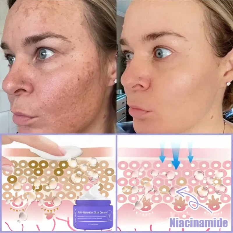❤️Bee Venom Lift Cream🐝Limited Time Offer🔥⌛