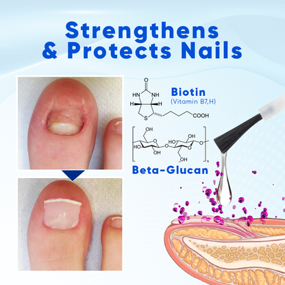 ⚡40% off for a limited time💅Nail Growth and Repair Serum 🩵