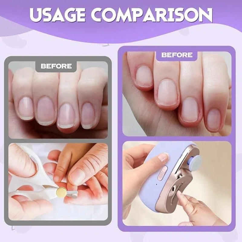 🔥 3-in-1 Electric Nail Clipper: Say goodbye to tradition and embrace the new era of smart manicure! 🔥