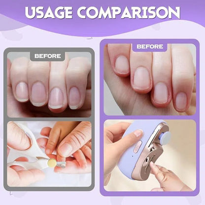 🔥 3-in-1 Electric Nail Clipper: Say goodbye to tradition and embrace the new era of smart manicure! 🔥