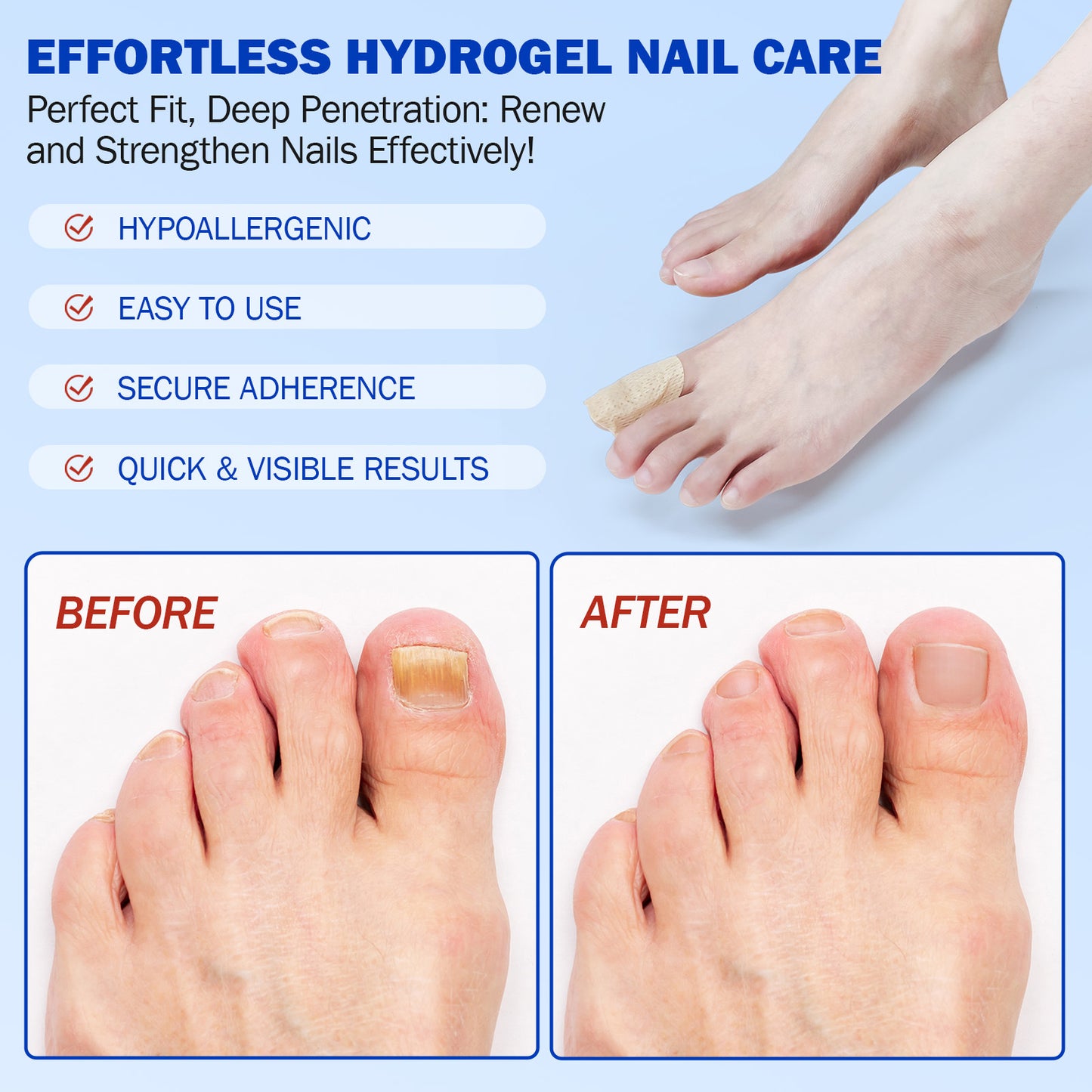🔥50% off💥 Toenail Fungus Treatment Extra Strength