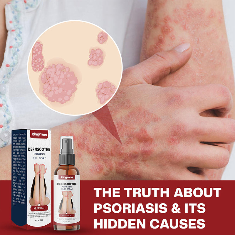 Psoriasis Relief Spray👨‍⚕️（Zero Itch, 3-Min Relief | All-Natural, 24/7 Repair ）🔥🎁Limited time discount