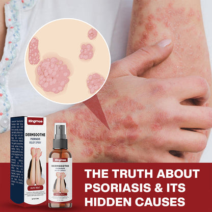 Psoriasis Relief Spray👨‍⚕️（Zero Itch, 3-Min Relief | All-Natural, 24/7 Repair ）🔥🎁Limited time discount