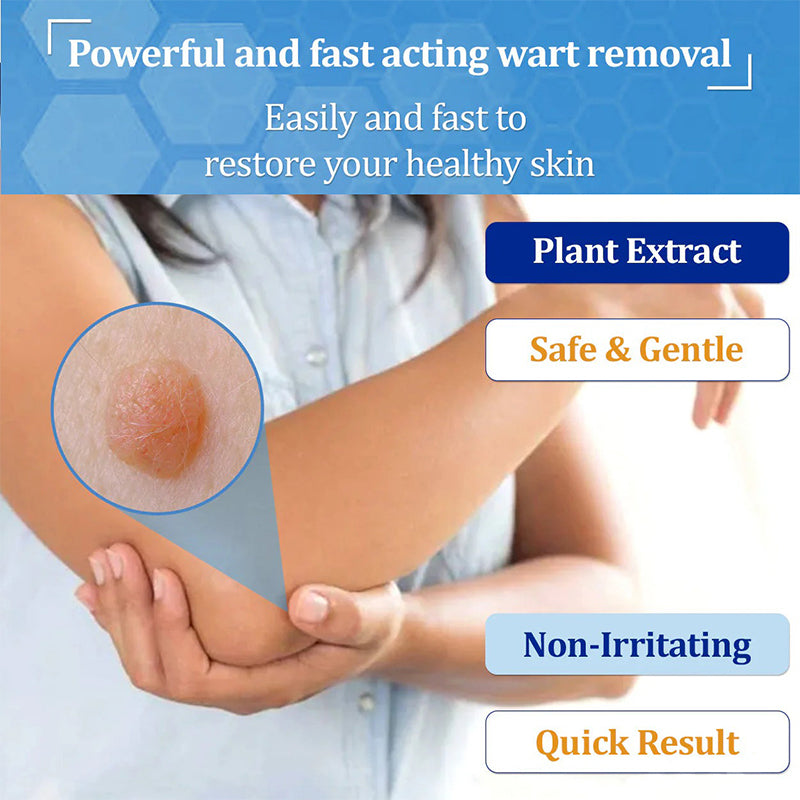 🐝RINGMOE™ BeeDerm Wart Solution—🚀 Sold out for the third time! 💥 Hot sale, hurry up! 🏃‍♀️