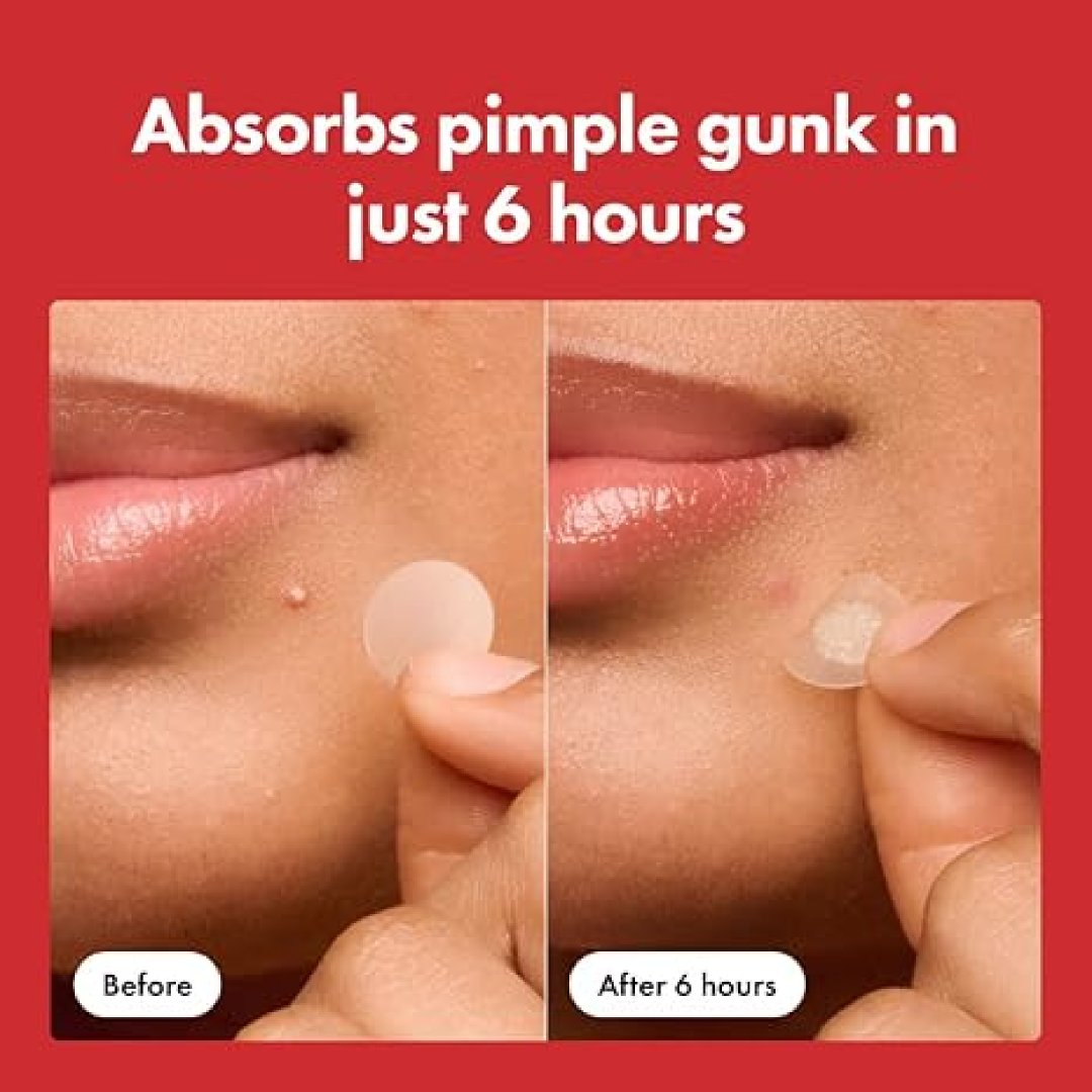 60% off free shipping, 36/72 hydrocolloid acne patches