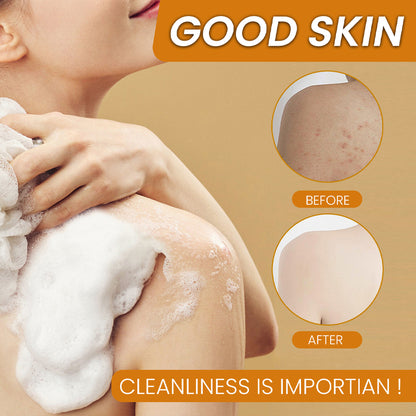 🌟Ginger Kojic Acid Brightening Soap｜🎁【Limited time offer, experience now】