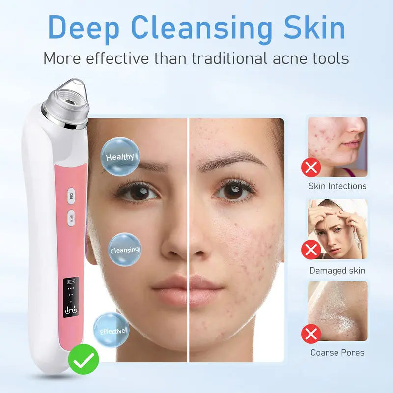 🔥 [Limited Time Flash Sale] Blackhead Extractor! 60% off! 🚚 Free Shipping! 🔥