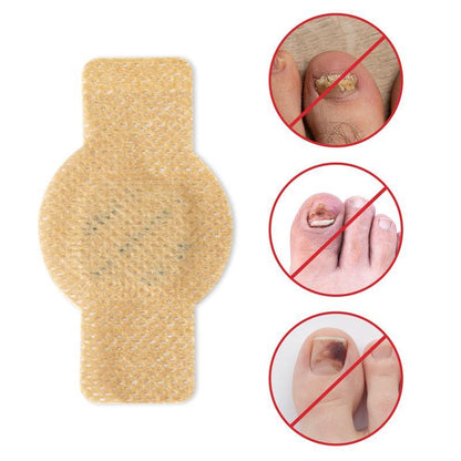 🔥50% off💥 Toenail Fungus Treatment Extra Strength