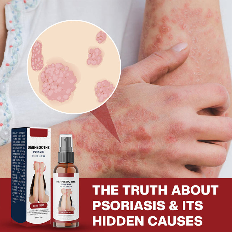 Psoriasis Relief Spray👨‍⚕️（Zero Itch, 3-Min Relief | All-Natural, 24/7 Repair ）🔥🎁